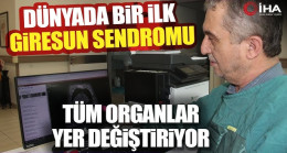 Tıp Tarihinde Bir İlk ”Giresun Sendromu”